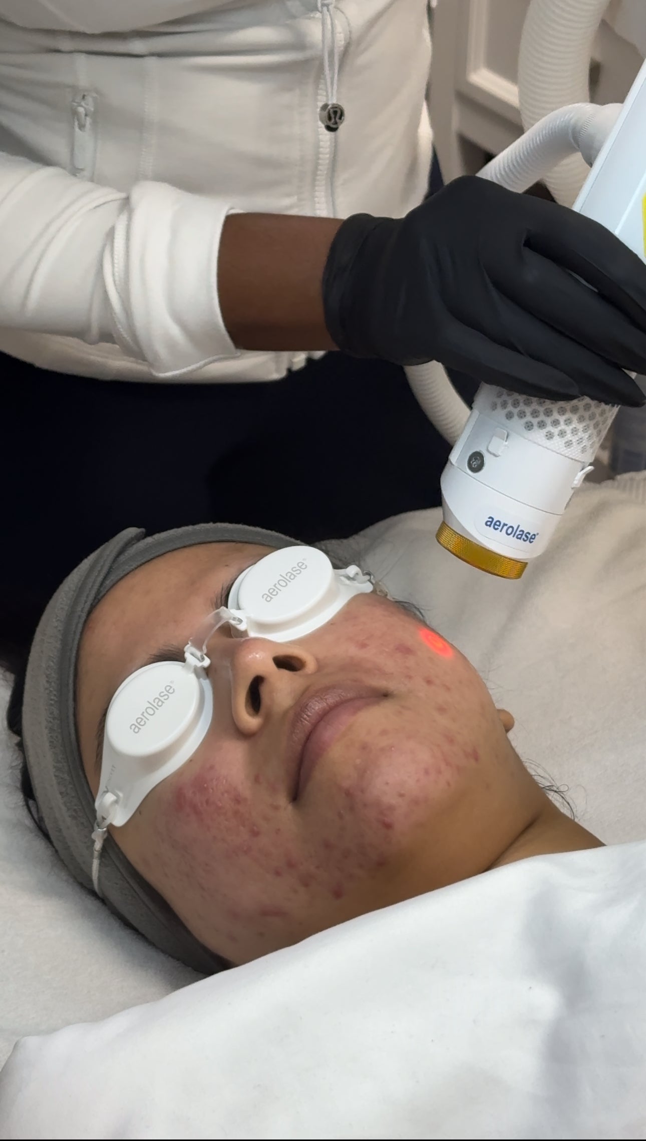 Aerolase Laser FAQ