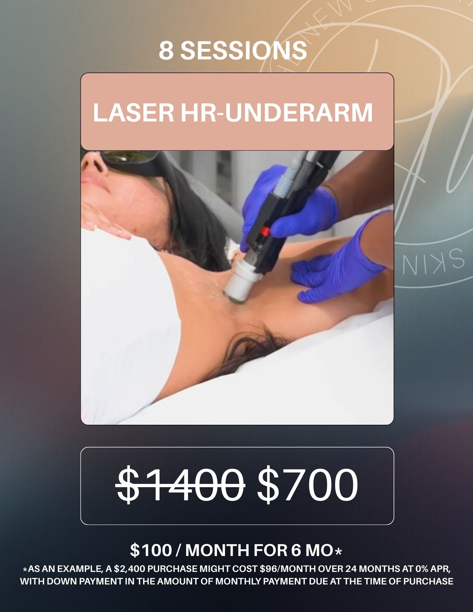 Laser Hair Removal Package of 8- Underarm
