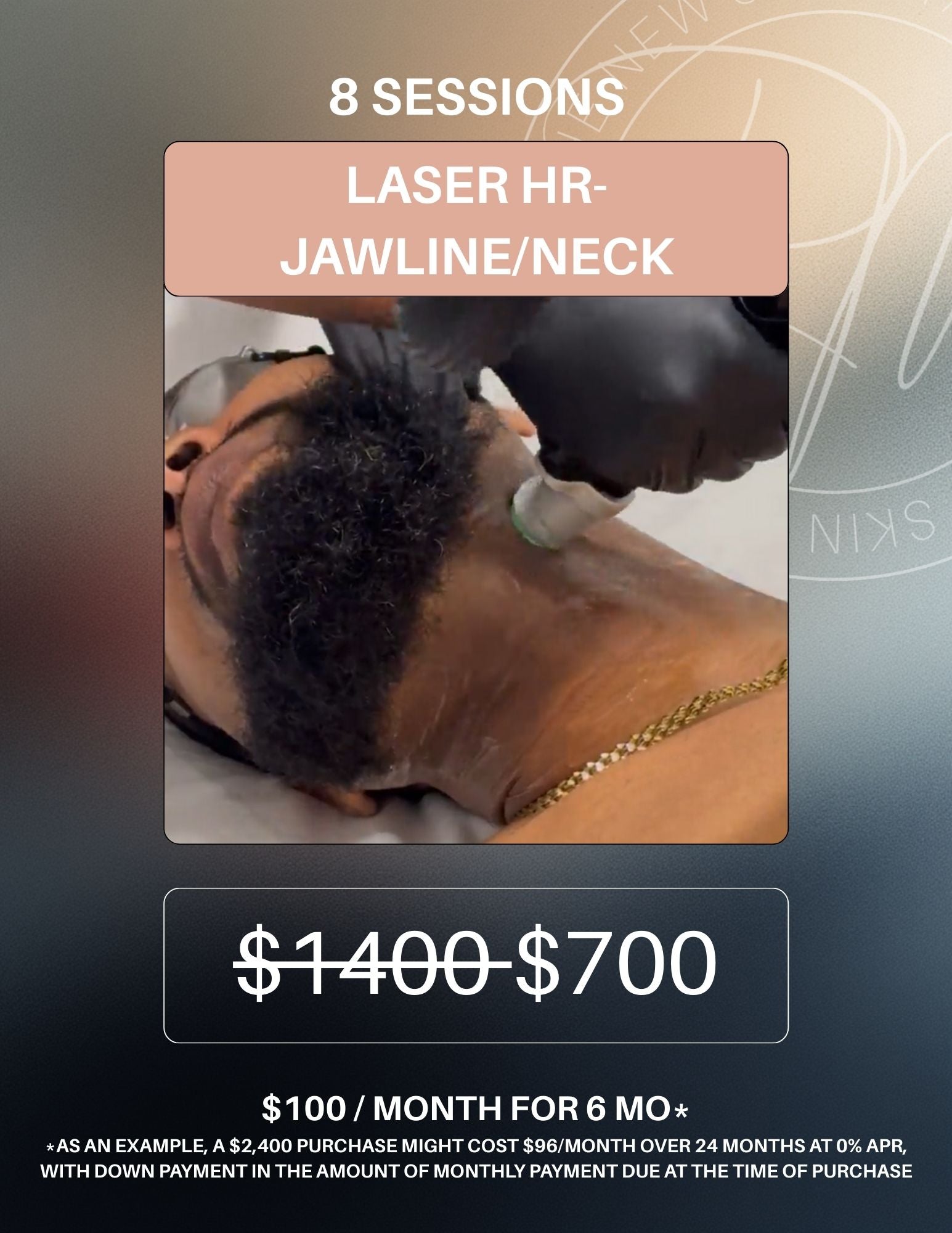 Laser Hair Removal Package of 8-Jawline/Neck