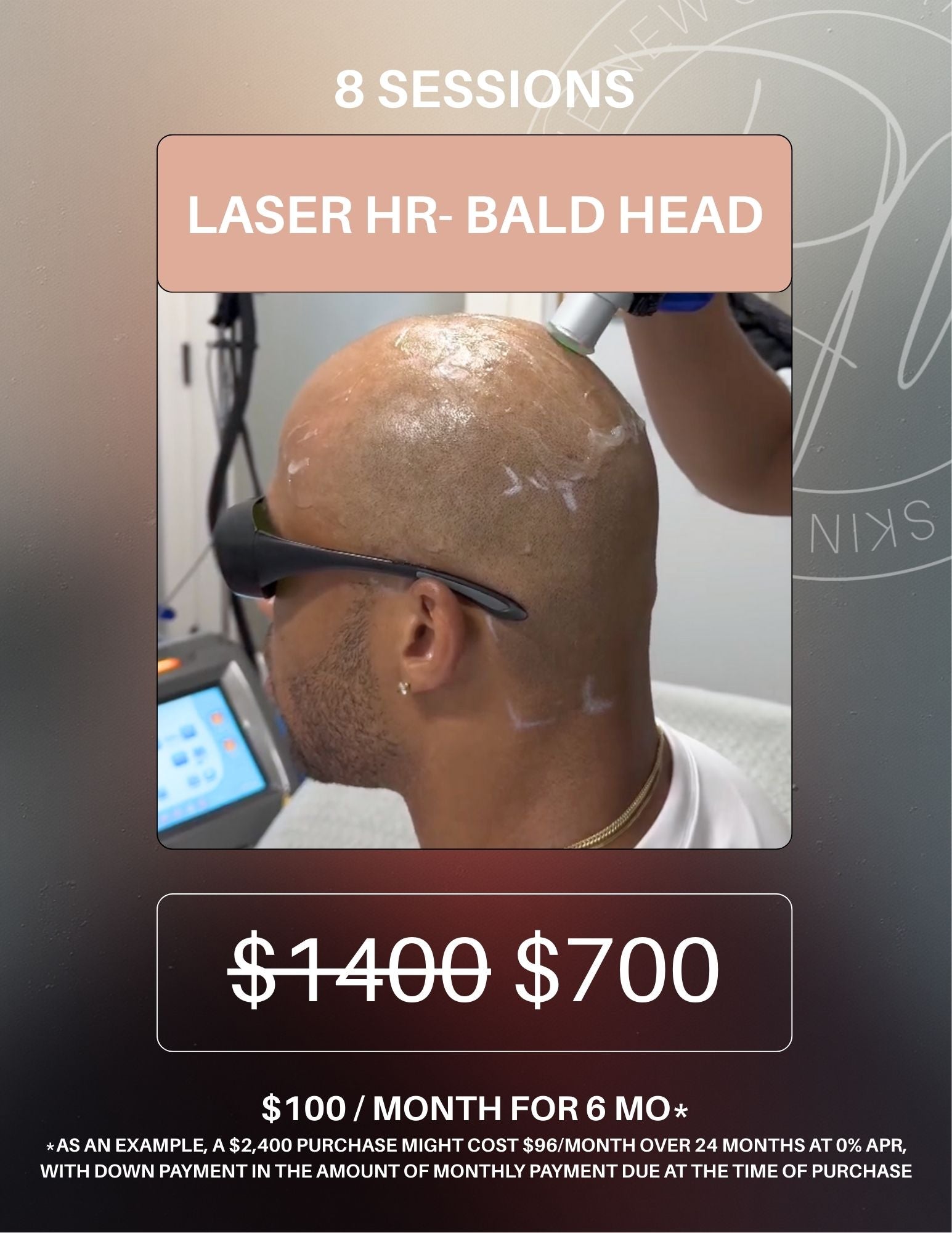 Laser Hair Removal Package of 8- Bald Head