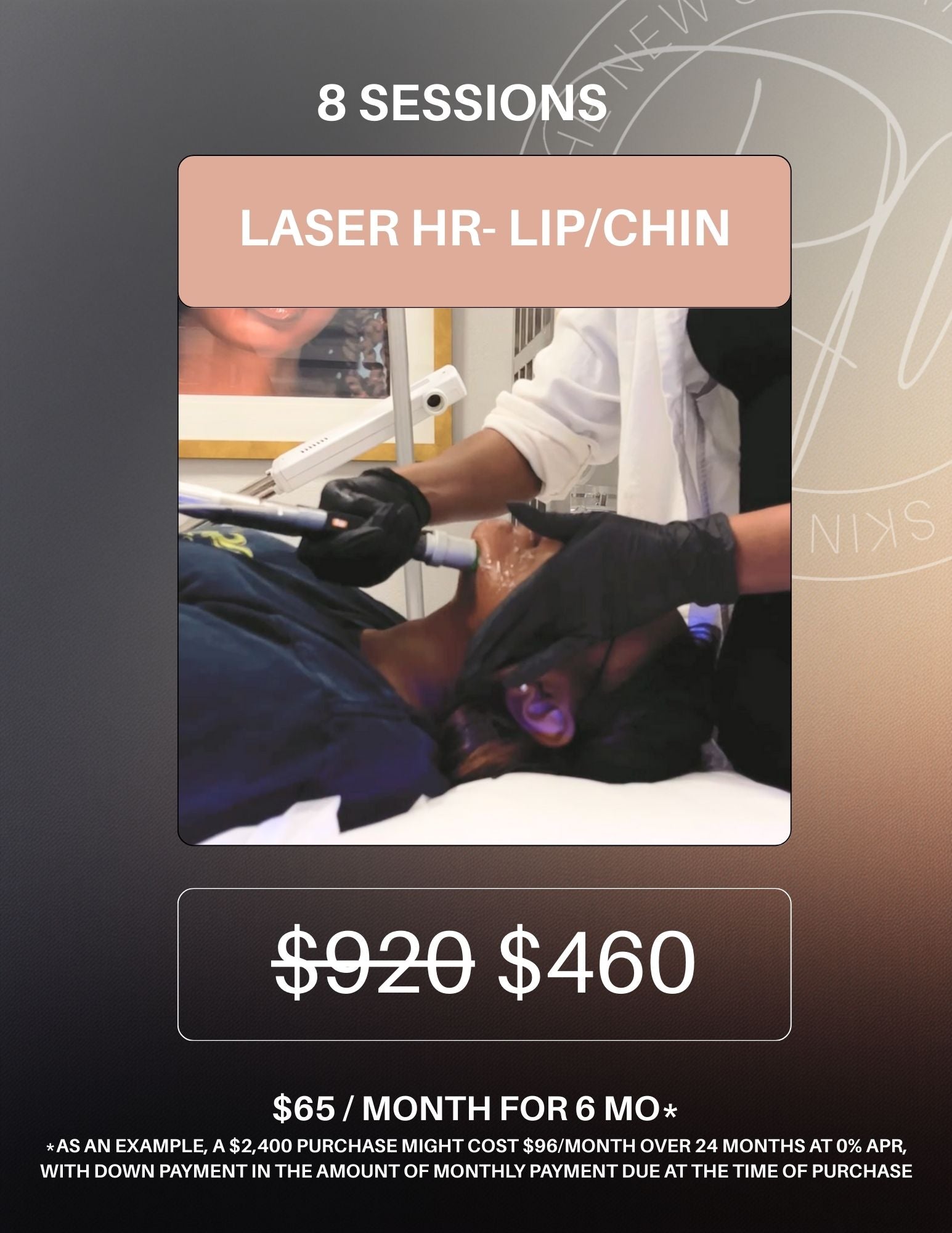 Laser Hair Removal package of 8- Lip/Chin