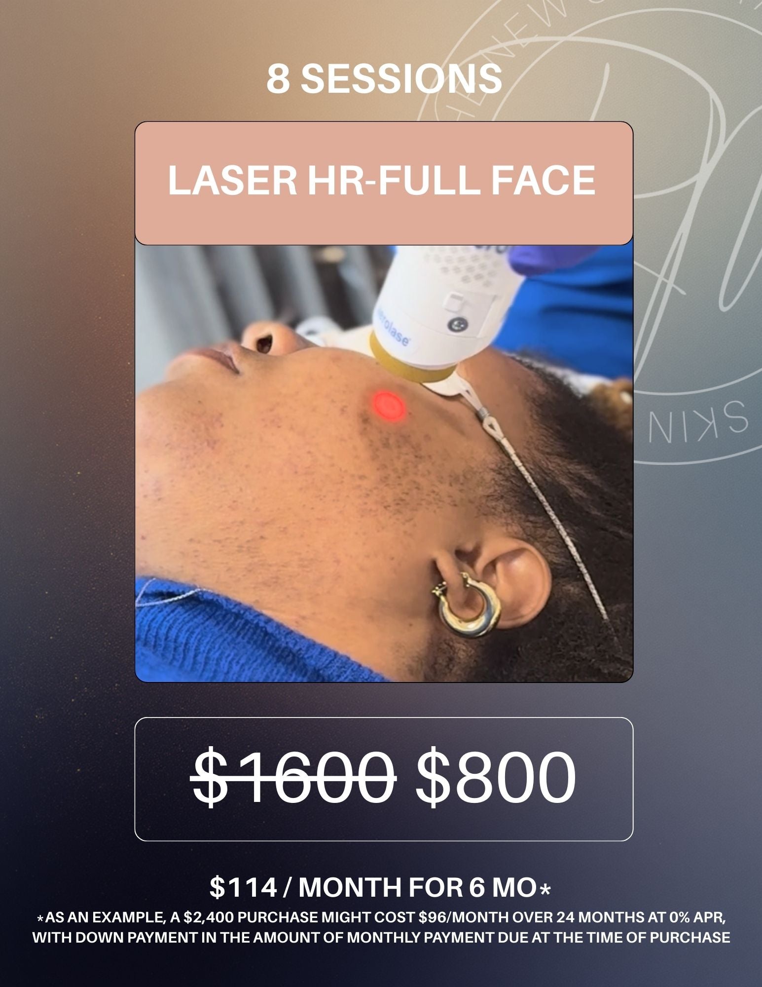 Laser Hair Removal Package of 8- Full Face