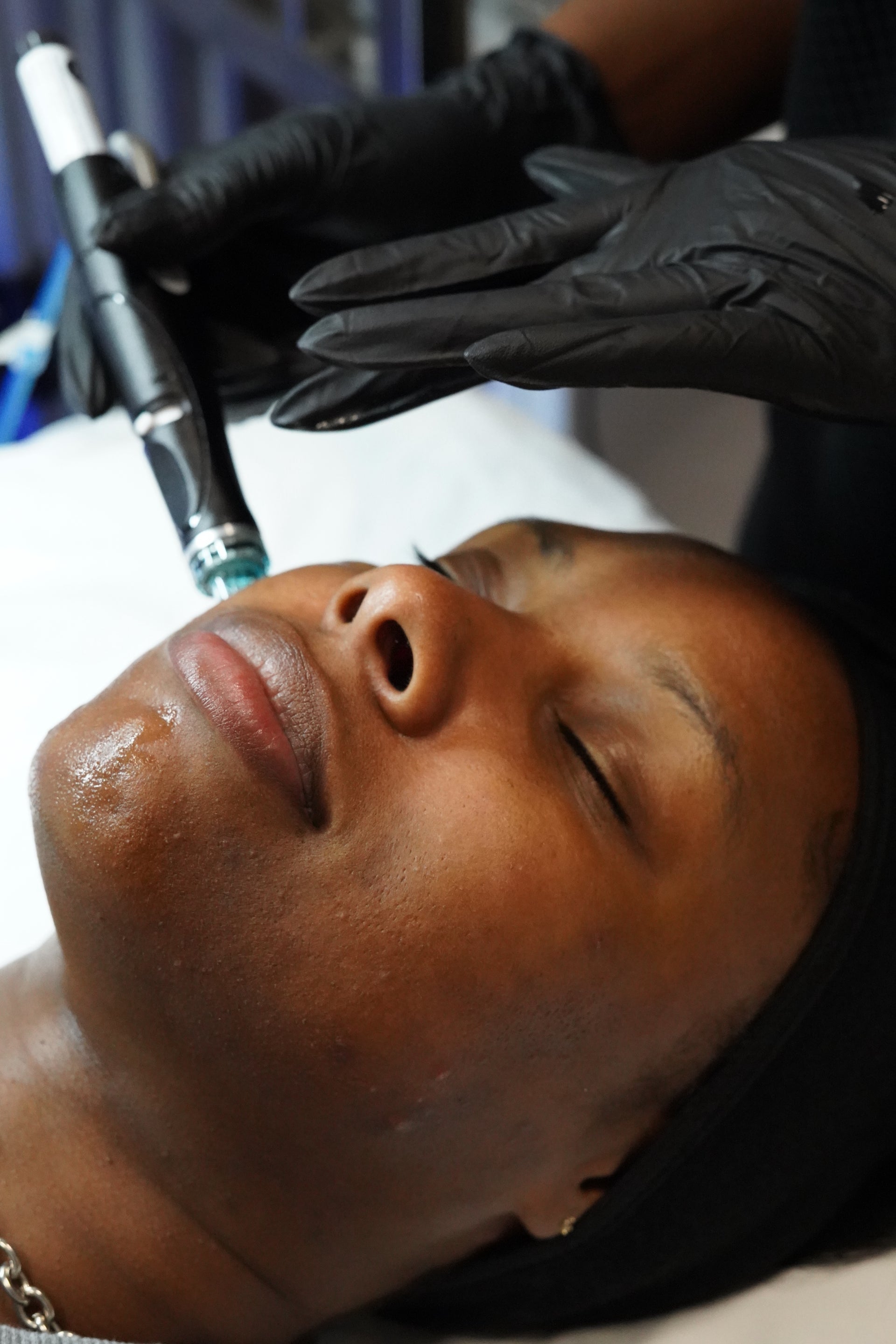 Hydrafacial Platinum Bundle