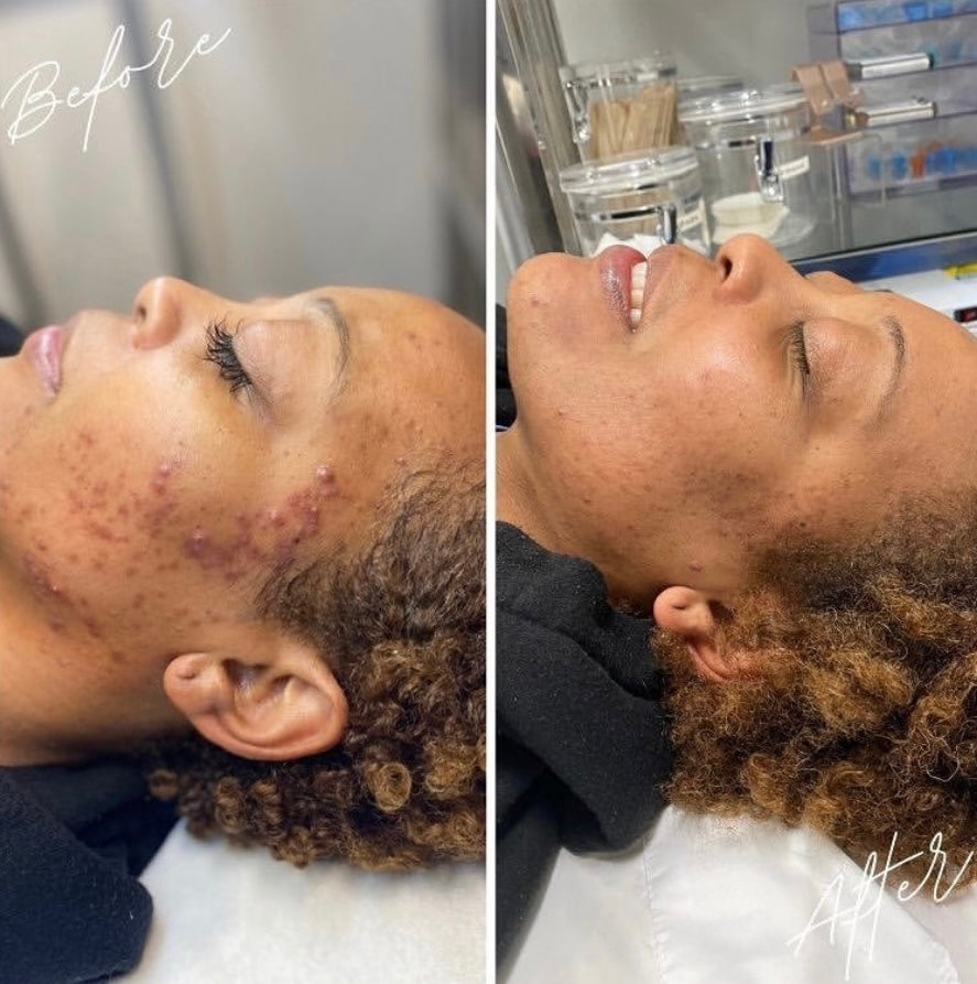 Clear Series Mini Bundle